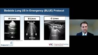 Implementation of the Bedside Lung Ultrasound in Emergency BLUE Protocol by Prehospital Paramedics [upl. by Florida]