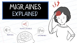 What are Migraines HealthSketch [upl. by Elva718]