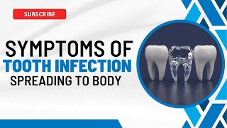 Tooth Infection Spreads Recognizing the Symptoms and What to Do [upl. by Ferdy774]