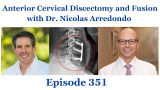 Anterior Cervical Discectomy and Fusion with Dr Nicolas Arredondo  OEP351 [upl. by Dmitri565]