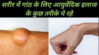 sharir mein kahin bhi ganth ho to yah ayurvedic dava istemal Karen गांठ का आयुर्वेदिक हर्बल इलाज [upl. by Bunder]