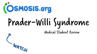 PraderWilli Syndrome Osmosis Study Video [upl. by Kcirtemed]