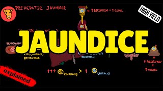 JAUNDICE Classification Pathogenesis Types of Jaundice Why urine is yellow [upl. by Prowel359]