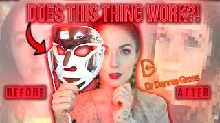 Dr Dennis Gross Spectralite Faceware Pro LED Mask HONEST REVIEW After 5 Months [upl. by Alburg74]