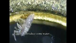 Springtails Under the Microscope [upl. by Yttisahc958]