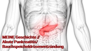 MEINE Geschichte  Akute PankreatitisBauchspeicheldrüsenentzündung [upl. by Norine]