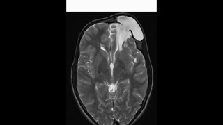 5 cases radiology in 5 minutes cnsneuroradiologyradiopediamrictxrayanatomybasicsradianttip [upl. by Raybourne54]