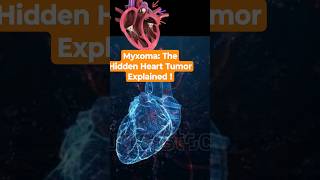 Myxoma The Hidden Heart Tumor Explained shorts shortsfeed hearthealth heart [upl. by Llabmik372]