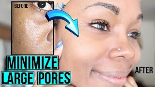 How to Get Rid of Large Pores LIKE A BOSS  Easy Regimen amp AT HOME REMEDIES [upl. by Norword]