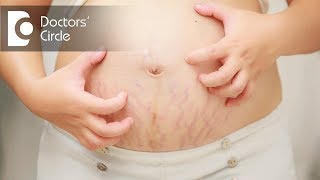 How to manage chronic itching amp rashes in young women started during pregnancy  Dr Nischal K [upl. by Middle490]