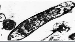 Plant Growth Promoting Bacteria Acidithiobacillus Ferrooxidan Iron Solubilizer For Rich Green Plants [upl. by Niel]