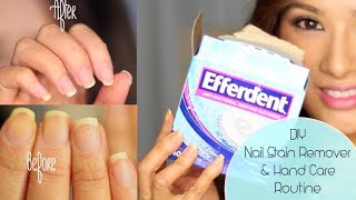 How to Get Rid of Yellow Nails amp Dry Hands  CLOSED Giveaway LOccitane amp London Butter [upl. by Tiemroth]