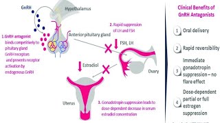 How do GnRH Analogues works  Zoladex  Prostap  Other GnRH Analogues [upl. by Rodolfo]