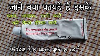 Framycetin Skin Cream hindi review  घाव जखम  जले कटे को ठीक करे ।। जाने कैसे use करे [upl. by Yelrebmik]