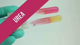 Urea Test [upl. by Massey263]