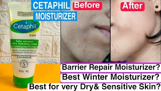 CETAPHIL Daily Advance Ultra Hydrating Lotion Review✅Best Winter Moisturizer For Dry Skin [upl. by Hach762]