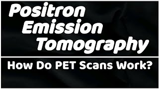 Positron Emission Tomography Revolutionizing Medical Imaging [upl. by Essy245]