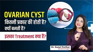 Ovarian cyst कितनी प्रकार की होती है क्यों बनती है  इसका treatment क्या है [upl. by Oler]