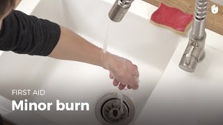 Learn first aid gestures Minor Burn [upl. by Poliard]