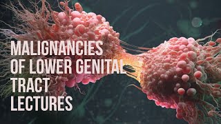 MALIGNANCIES OF LOWER GENITAL TRACT lecture 1 Premalignant disease of CERVIX important MCQs [upl. by Conan160]