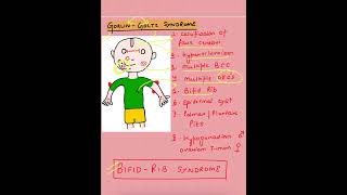 Gorlin Goltz syndrome  Bifid Rib syndrome  Oral Pathology  bds oralpathology syndromes mds [upl. by Aylatan798]