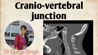 Craniovertebral junction Anatomy and Radiology [upl. by Adena]