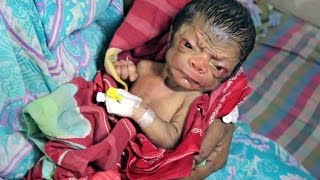 Shocking Face Of Newborn Baby Who Looks 80yearsold [upl. by Eolande894]