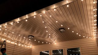 Brightown Outdoor Cafe Patio String Lights REVIEW [upl. by Esorylime91]