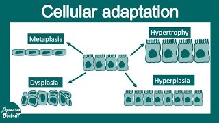 metaplasiahyperplasiahypertrophy and atrophy [upl. by Skipton53]