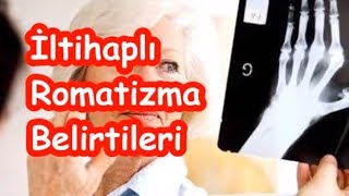 İltihaplı Romatizma Belirtileri [upl. by Bekki]