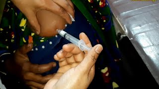 Arm injection IM Soma Ject Injection Push √√ Injection Video  জন্মবিরতিকরণ ইনজেকশন 24 Ep14 [upl. by Plusch]