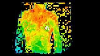 The Clinical Applications of Digital Thermal Imaging [upl. by Landis]