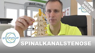 Spinalkanalstenose  Enge im Spinalkanal [upl. by Asilaj]