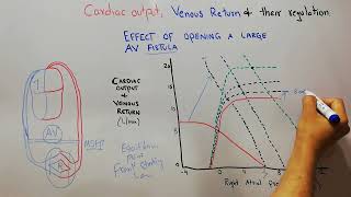 CVS 185  what is the effect of opening arteriovenous fistula on cardiac output amp venous return [upl. by Elinor]