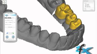 Zfx CAD Software  Bridge [upl. by Caldera736]