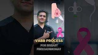 Process of Breast LumpFibroadenomas Removal [upl. by Stutman]