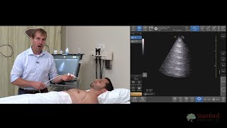 Point of Care Lung Ultrasound POCUS [upl. by Anawk507]