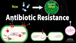 Antibiotic Resistance Animation [upl. by Ennasil689]