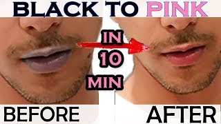 HOW TO GET RID OF DARK LIPS BLACK LIPS AT HOME WITH EASY METHOD   GET BABY SOFT PINK LIPS [upl. by Zarihs243]