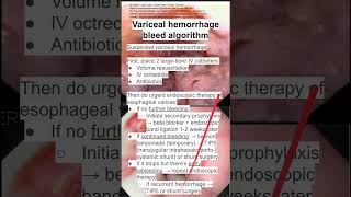 Variceal hemorrhage bleed algorithm [upl. by Emelin803]