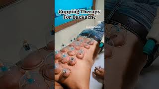 Cupping Therapy for Back Pain Muscular Pain amp Stiffness [upl. by Willett]