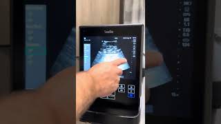 Sonosite s2 bladder scanner function [upl. by Nytnerb]