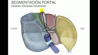 Segmentacion hepática [upl. by Goines]