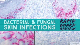 Infectious Dermpath bacterial amp fungal Board Review for Dermatology amp Pathology 20 cases [upl. by Moorefield]