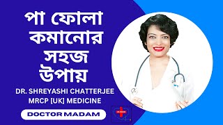 পা ফুলে গেলে করণীয়  Swollen Legs and Feet Treatment  পা ফোলা কমানোর ঘরোয়া উপায় ও চিকিৎসা [upl. by Sheeb]