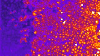 Calcium imaging in keratinocytes with Fluo4AM dye [upl. by Lekkim218]