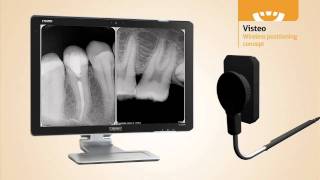 Dental Sensor  Owandy Visteo new concept in Digital Radiography [upl. by Marlo]