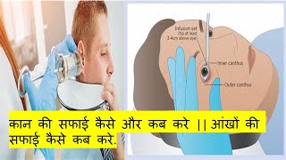 EYE IRRIGATION  EAR IRRIGATION  कान की सफाई कैसे और कब करे  आंखों की सफाई कैसे कब करे [upl. by Yeltsew]