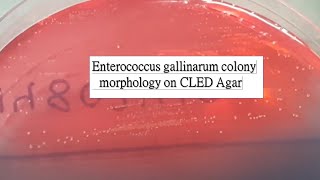 Enterococcus gallinarum colony morphology on CLED Agar of Urine Culture [upl. by Ute223]