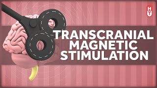 Transcranial Magnetic Stimulation How Does that Work [upl. by Deanne168]